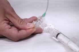 Un hospital de Córdoba realizó un implante inédito para tratar un aneurisma
