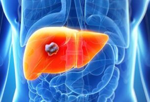 Identifican una nueva vía para potenciar la inmunoterapia contra el cáncer de hígado